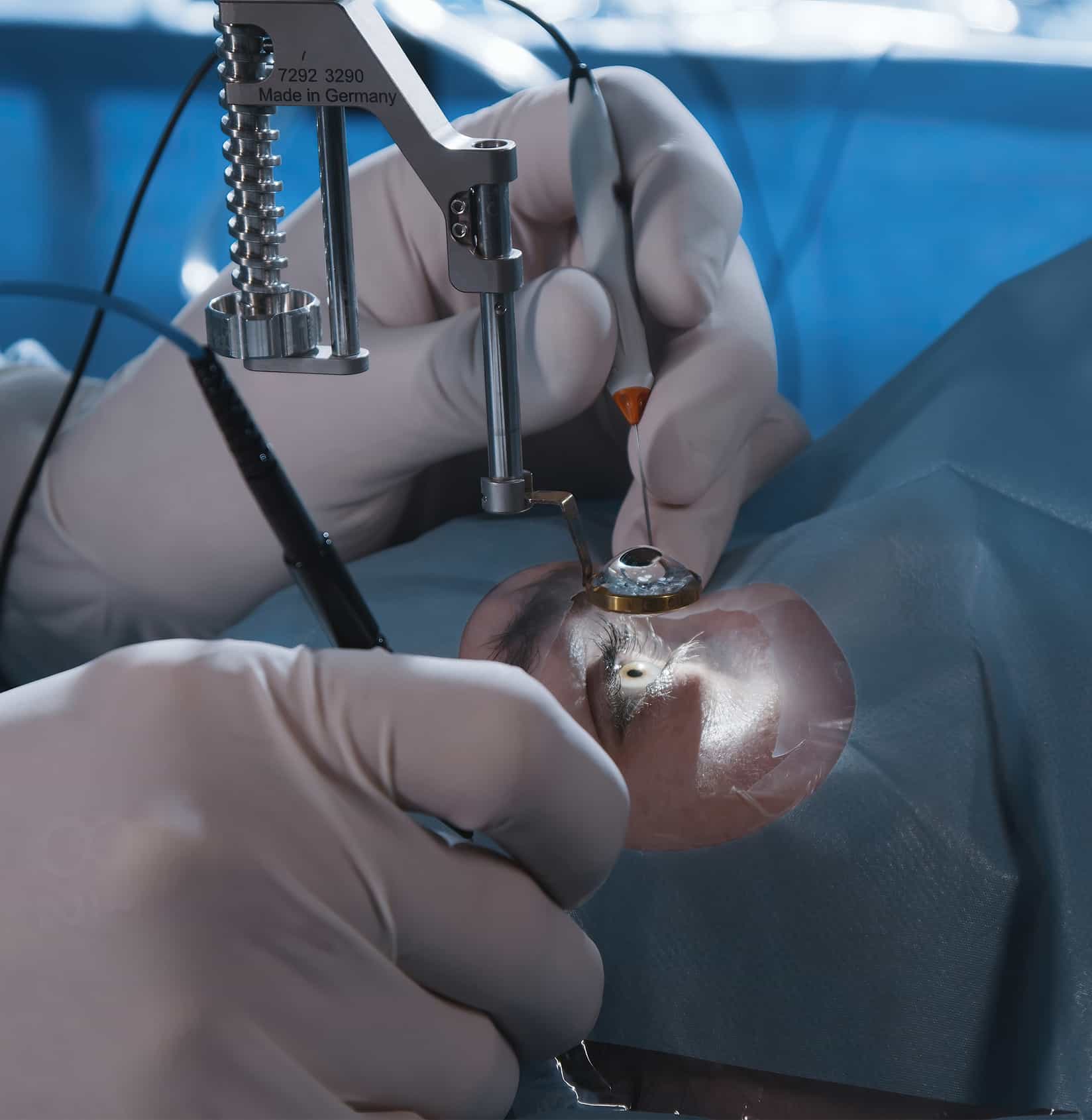 Eye surgery